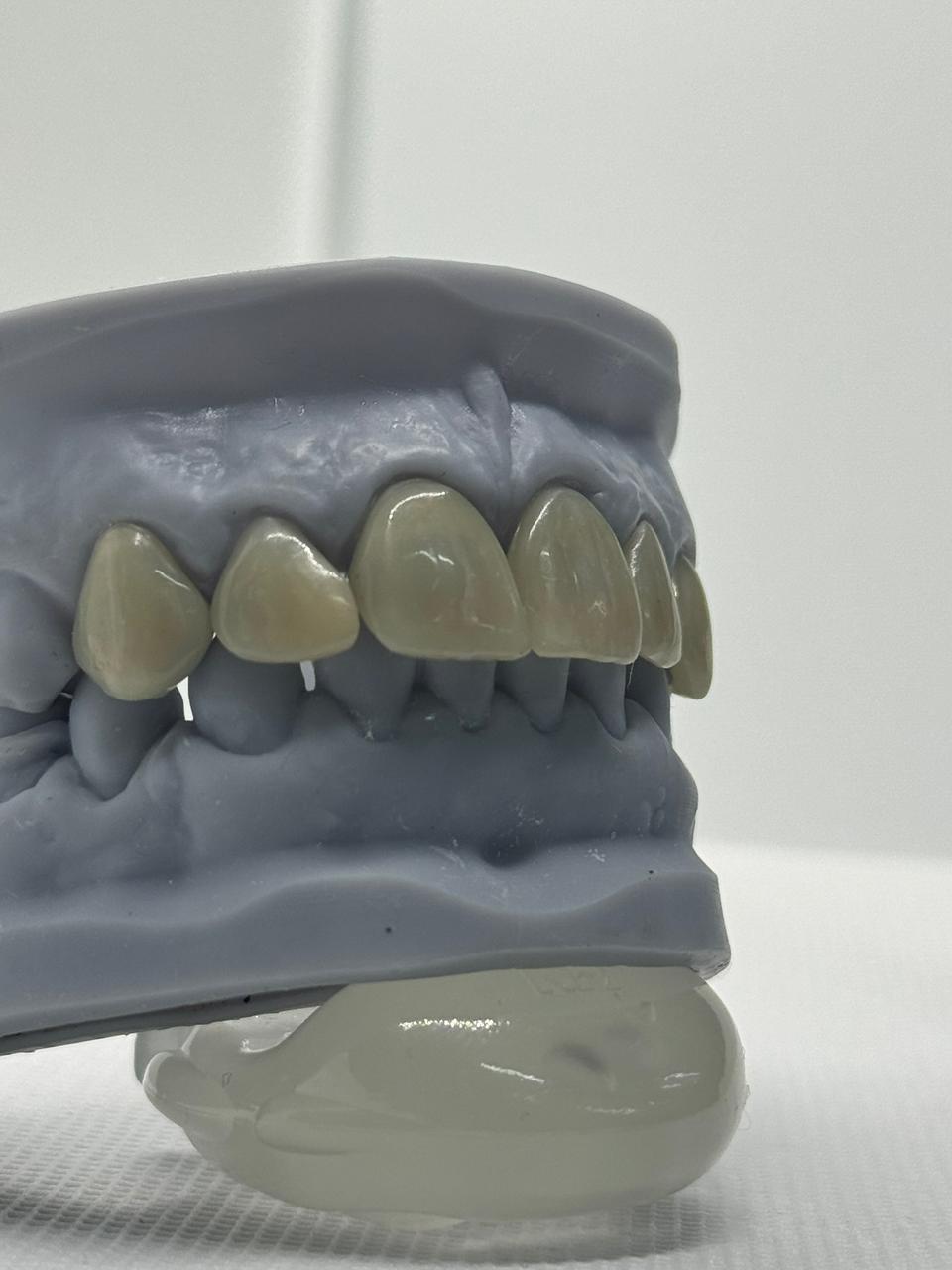 Modelo lateral