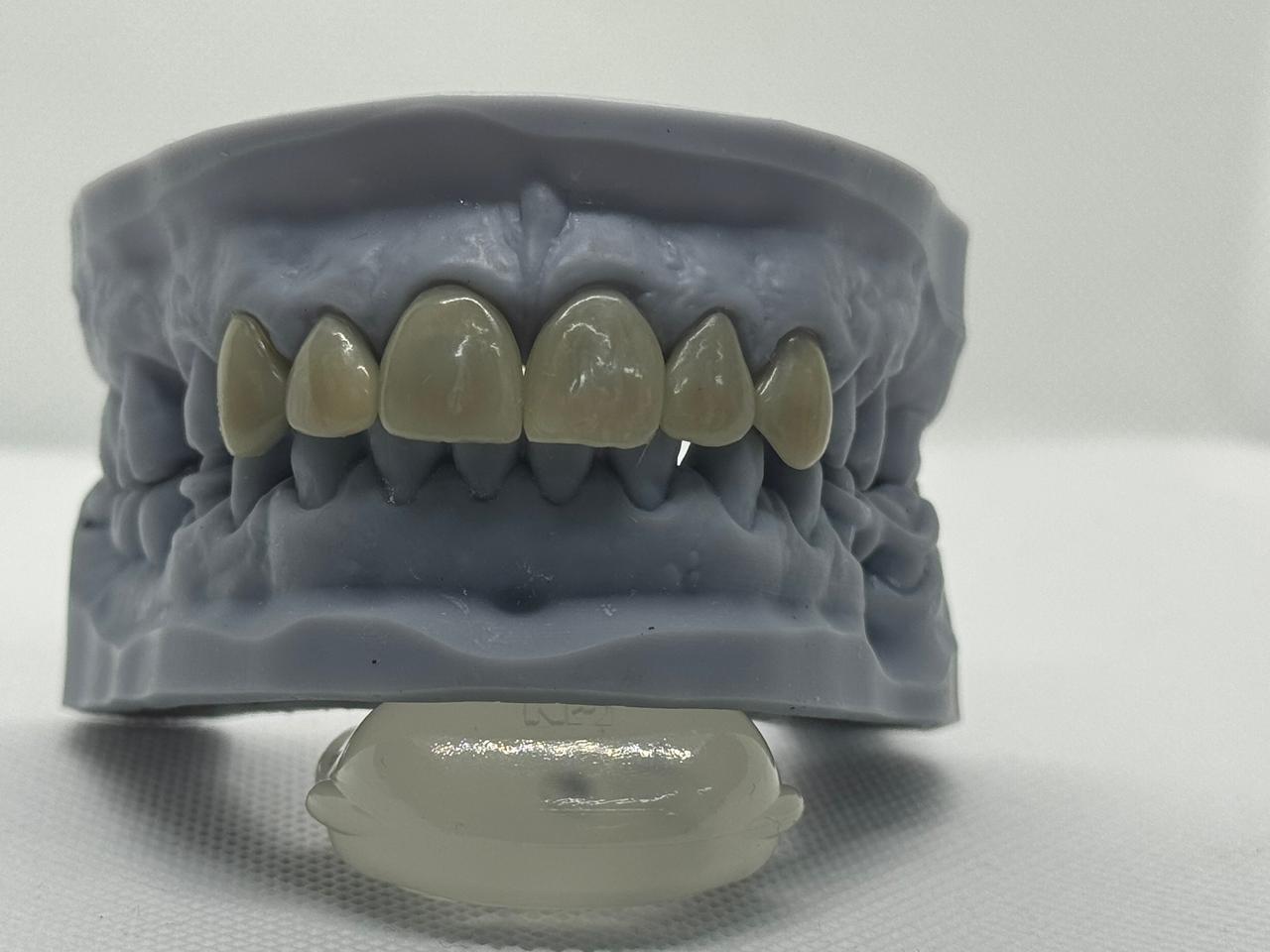 Modelo frontal