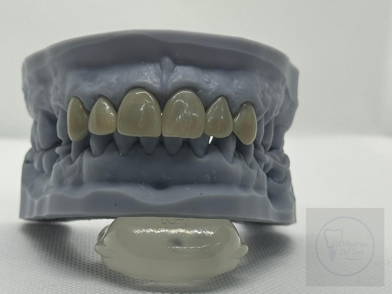 Modelo frontal