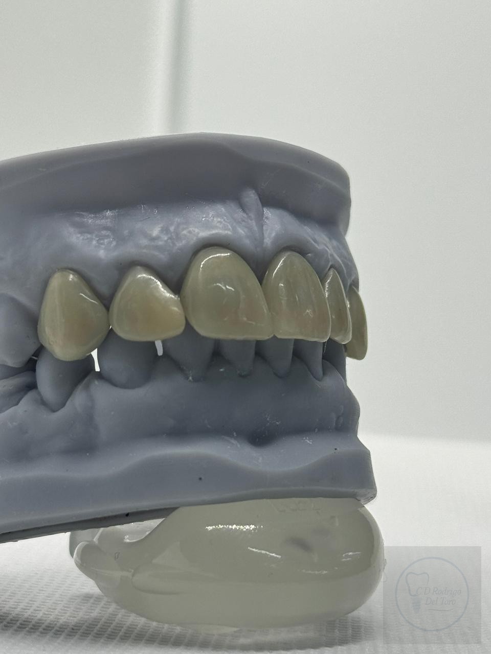 Modelo lateral