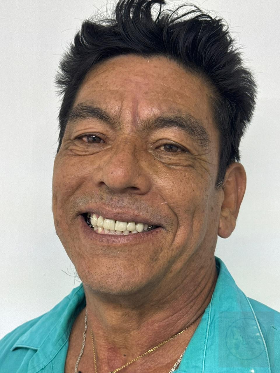 Resultado paciente